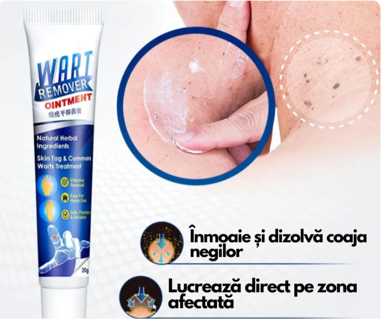 WartRemover - Crema Anti Negi si Bătături