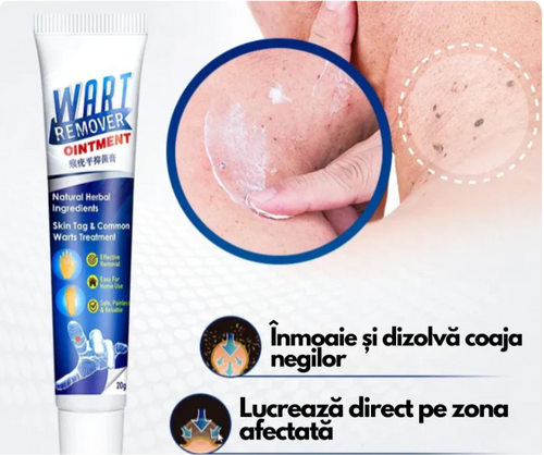 WartRemover - Crema Anti Negi si Bătături