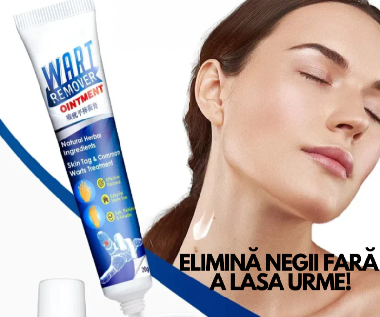 WartRemover - Crema Anti Negi si Bătături
