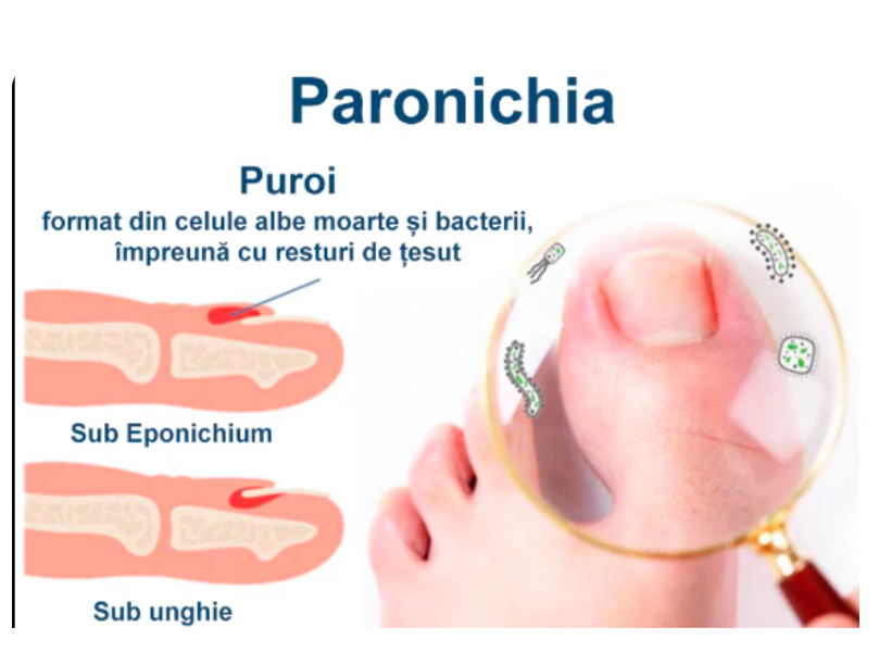 Uleiul ToenailPlus-Regenerarea unghiilor