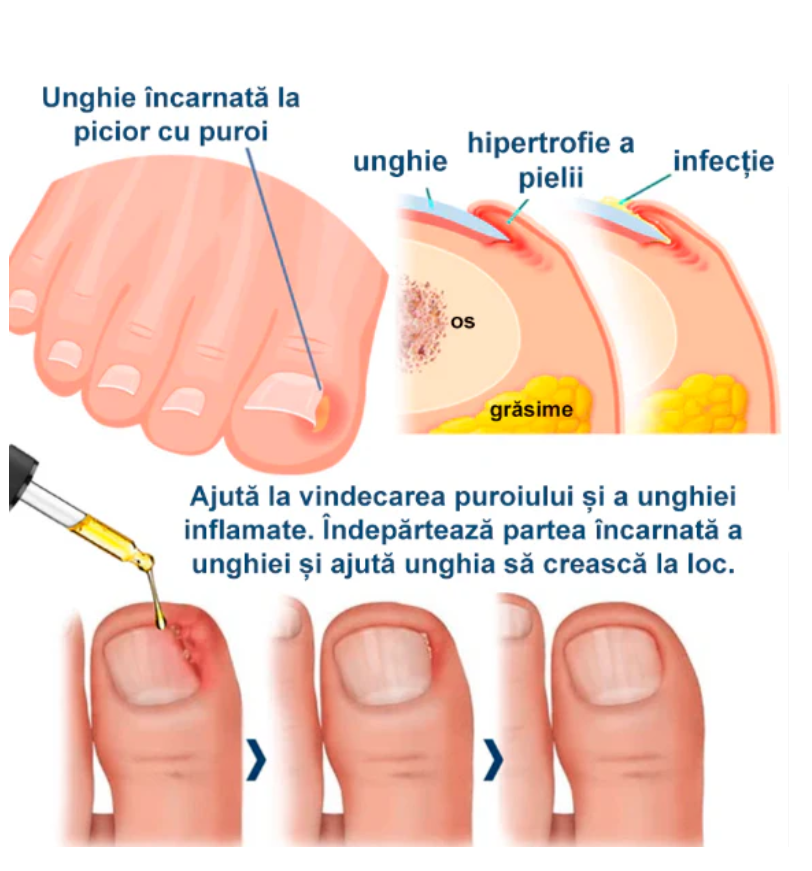 Uleiul ToenailPlus-Regenerarea unghiilor